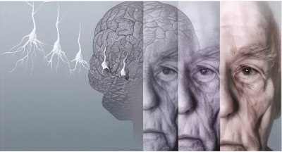 Envejecimiento Envejecimiento